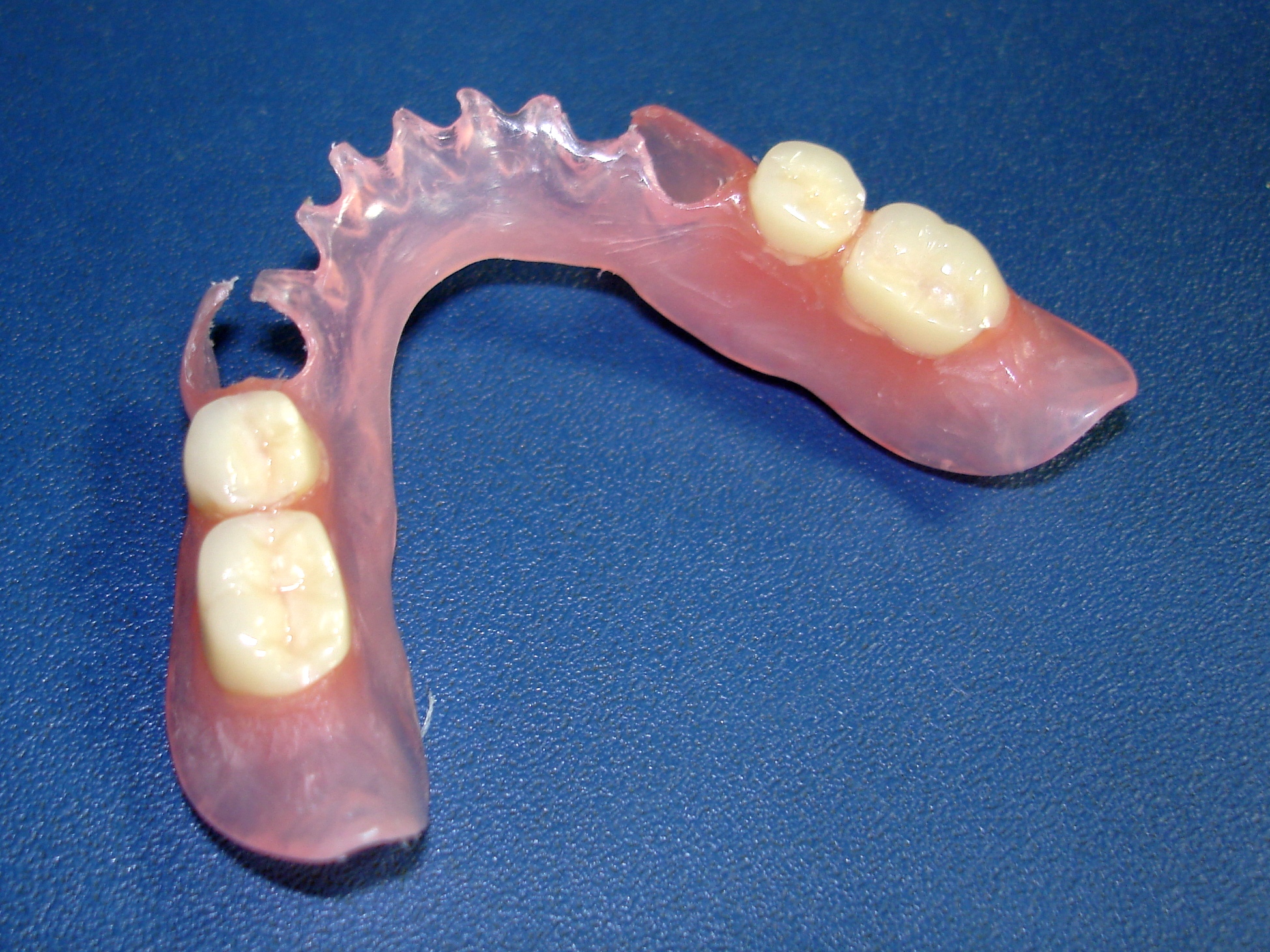 Верхний зубной протез с небом фото